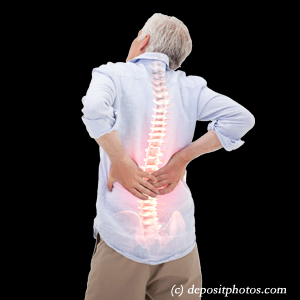 picture San Jose back pain with lumbar spinal stenosis